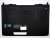 Топкейс  для ноутбука ASUS G751JM